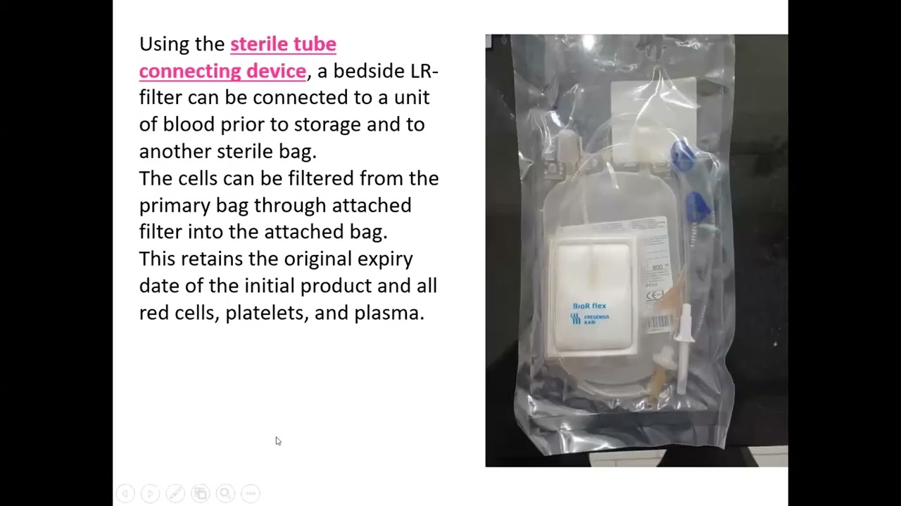 CDE - 113 : What Exactly   Are We Transfusing? Leucoreduction From Bench to Blood Bag