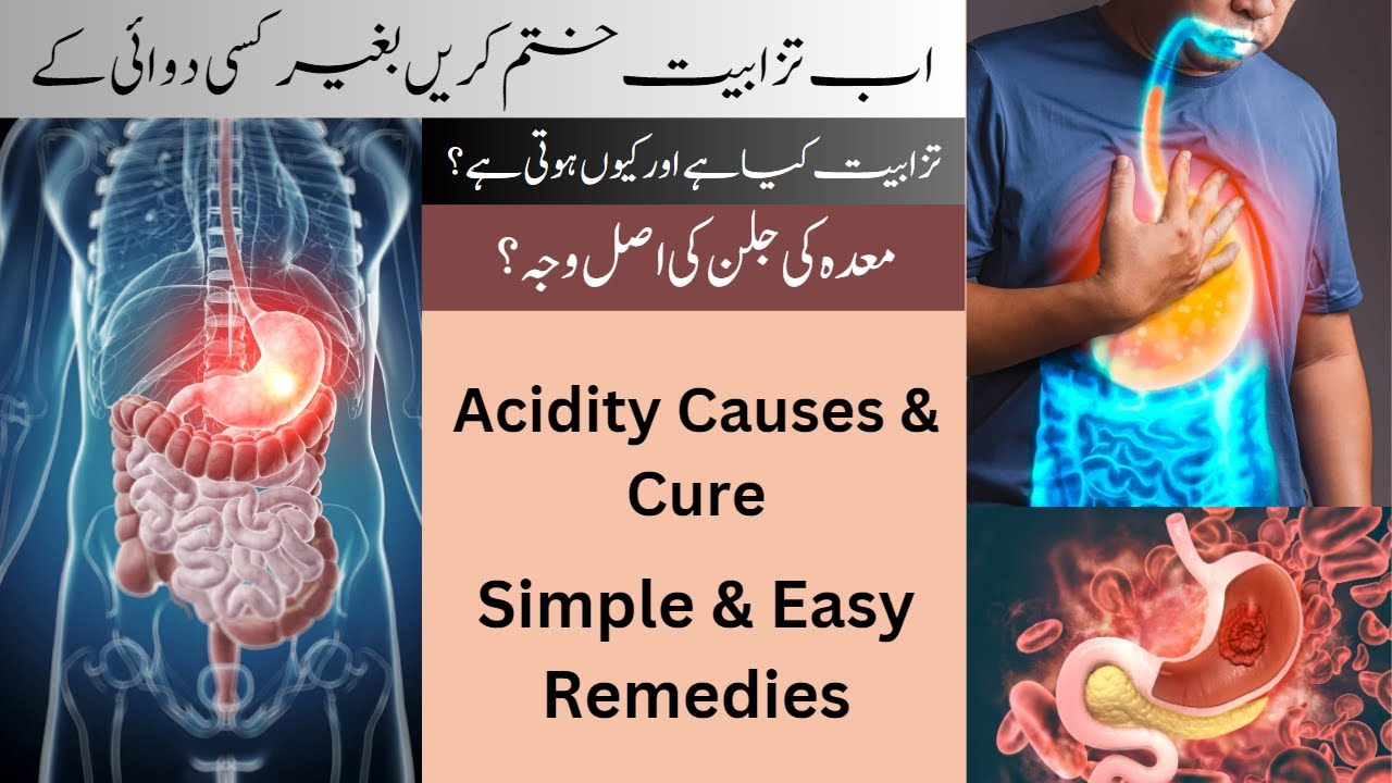 Acidity Home Remedies Symptoms Of Acidity How To Get Rid Of Acidity how-to-get-rid-of-acid-reflux-permanently-treat-acid-reflux-naturally