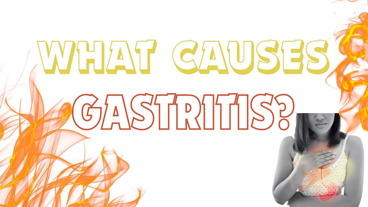 Factors that cause Gastritis Amlapitta causative factors Why does