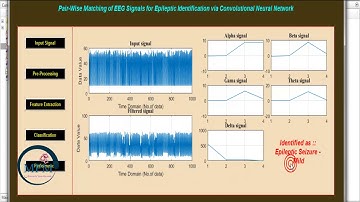 Pair Wise Matching of EEG Signals for Epileptic Seizures identification via CNN using MATLAB