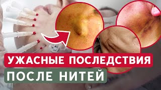 Об этом НЕ предупреждают! / Что может пойти НЕ так?