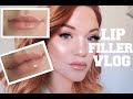 LIP INJECTIONS VLOG JUVEDERM XC