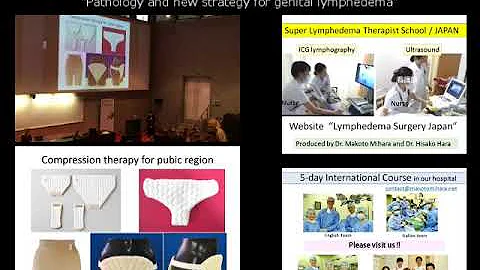 LVA for genital lymphedema presented by Dr. Makoto...
