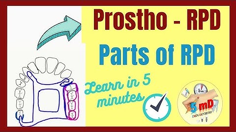 RPD | PARTS OF REMOVABLE PARTIAL DENTURE | Prosthodontics