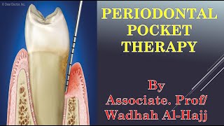 36-Periodontal surgery-5 (Periodontal pocket Therapy)- Wadhah Periodontology lectures. د/ وضاح الحاج