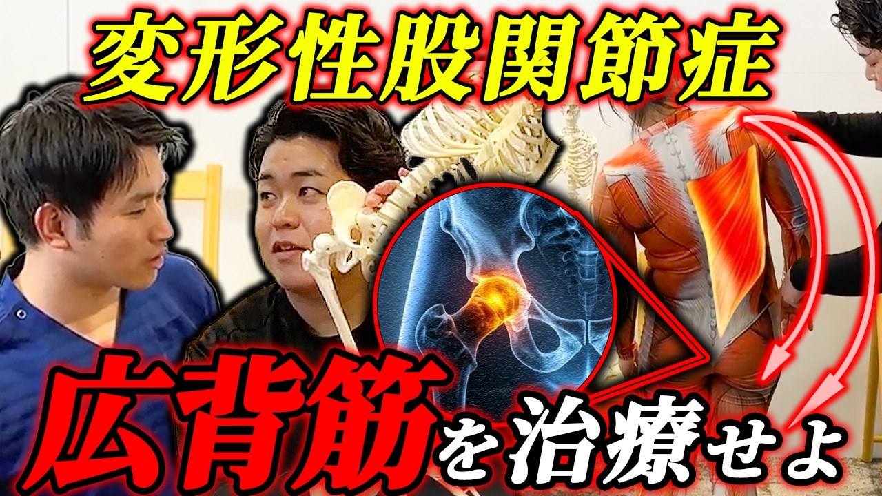 【変形性股関節症】股関節周りの治療だけで終わってませんか？