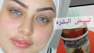 مطبخ ام عائشة _om Aisha وصفة لتفتيح البشرة _وازالة الكلف و البقع الداكنة والتصبغات  بمكونات بسيطة