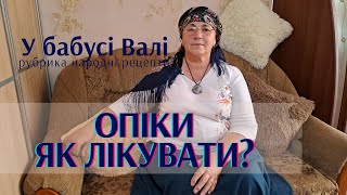 Як лікувати опіки? Опіки, що робити? Народні рецепти