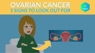 Signs of Ovarian Cancer: Do You Know Them All?