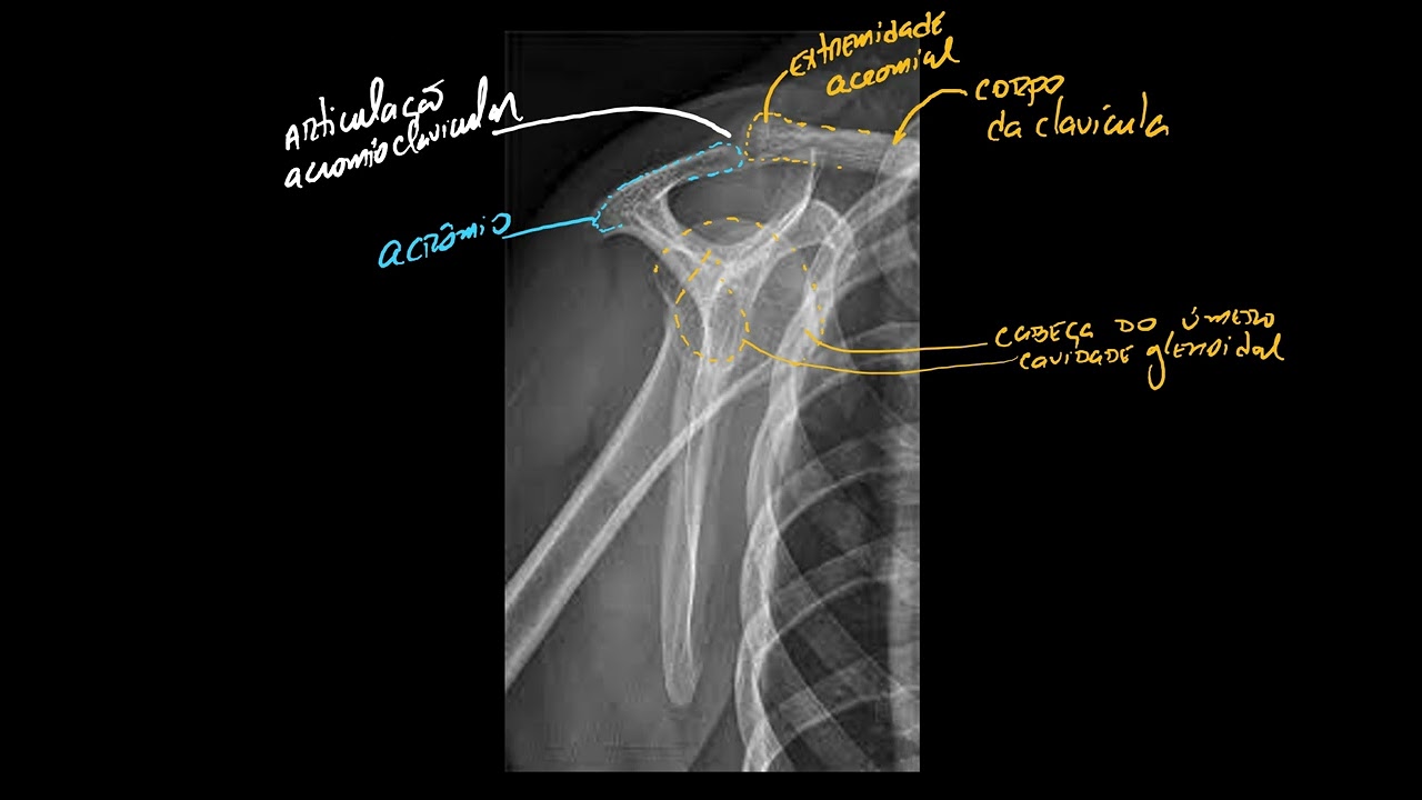 Radiografia Y escapular 