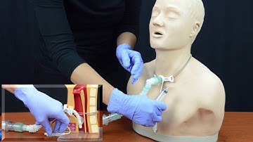 Minimal Leak Technique