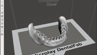 Microlay DentalFab | Printing using the touch display