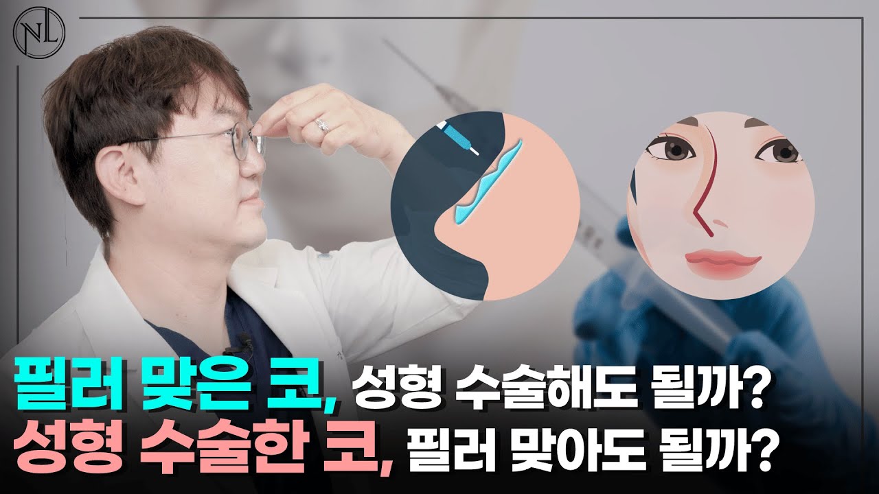 코 필러와 코성형 차이점 및 동시 시술 가능 여부