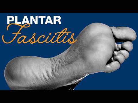 Injury Spotlight - Plantar Fasciitis