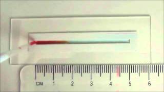 Multi-gradient hydrogels produced layer by layer with capillary flow and crosslinking in open...