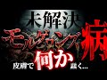 現実か妄想か？未解決論争「モルゲロンズ病」 thumbnail