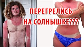 СОЛНЕЧНЫЙ ОЖОГ после загара | 5 САМЫХ ЭФФЕКТИВНЫХ НАРОДНЫХ СРЕДСТВ от солнечных ожогов!(, 2016-07-10T14:37:18.000Z)