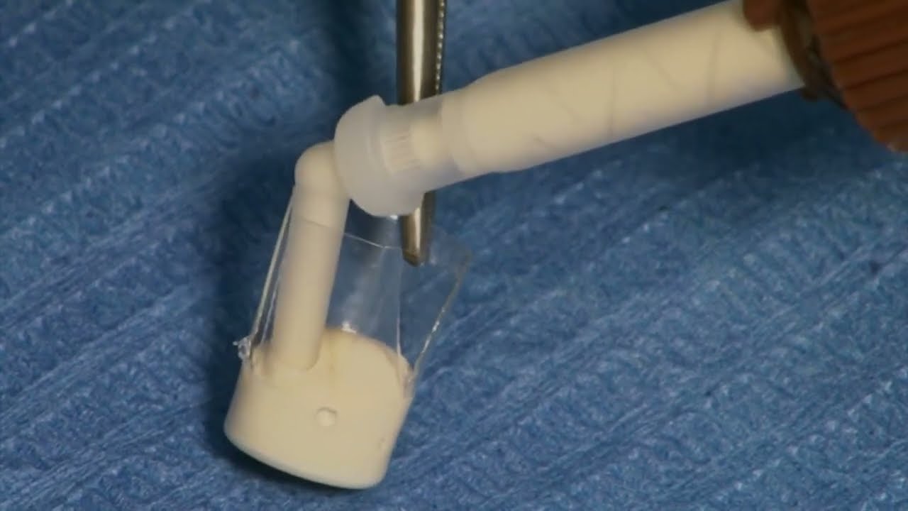 Dentocore and Dentocore Body - Core build up and post cementation composite material