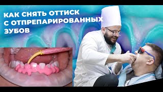 ОРТОПЕДИЧЕСКАЯ СТОМАТОЛОГИЯ КАК СНЯТЬ ОТТИСК?