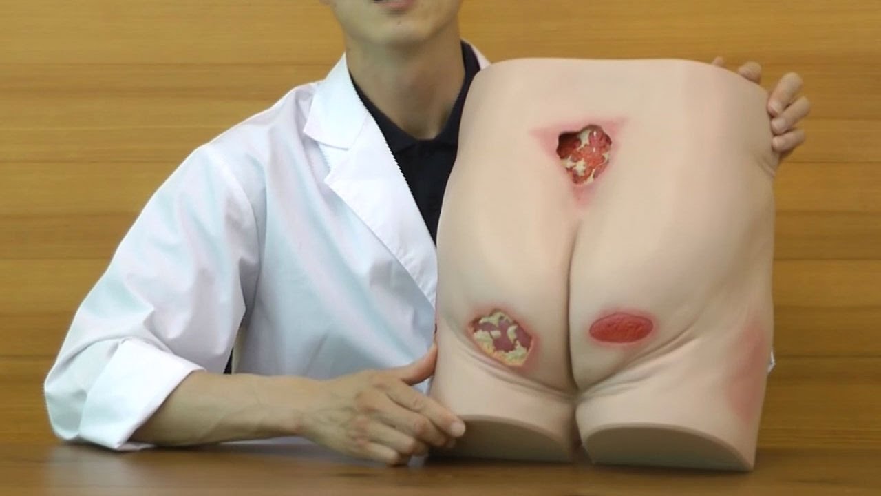 I Iv度の褥瘡をリアルに再現した褥瘡ケアトレーナー P15 Youtube I Iv度の褥瘡をリアルに再現した褥瘡ケアトレーナー P15 Youtube