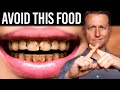 The Worst Food for Your Teeth Is NOT SUGAR