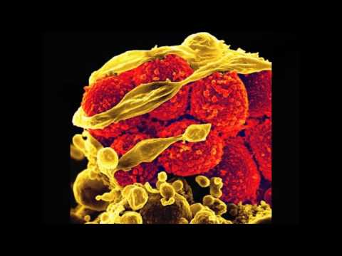 Nosocomial Infections