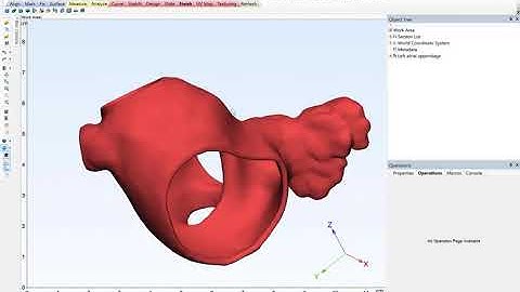 How to Label 3D-Printed Anatomical Models | Materialise Mimics 22