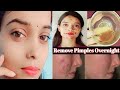 How to remove pimples overnight  natural home remedy  simmi simu