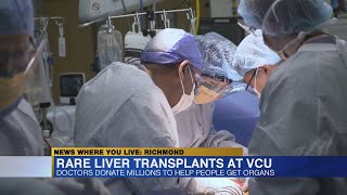 Rare liver transplants at VCU