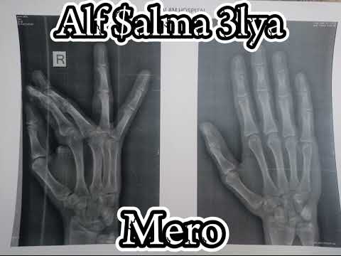 ميرو ام سي الف سلامه عليا     3