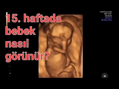 15 haftalık gebelik: dört boyutlu ultrasonografide kız bebek nasıl görünür?