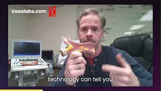 How Carotid Intima-Media Thickness (CIMT) Testing Is Changing Lives