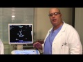 Proactive management of the rv  imacor htee patient educational series