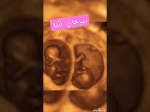 كيف يظهر التوأم داخل الرحم سبحان الله العظيم