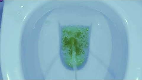 Use MenHealth to monitor and track your urine flow