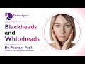 Treatment of Blackheads and Whiteheads | Blackheads और Whiteheads का इलाज | Dr. Poonam Patil