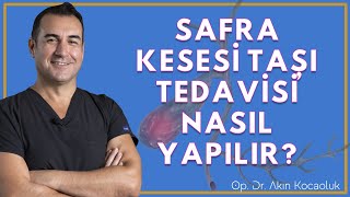 Safra Kesesi taşı nedir? Belirtileri nelerdir? Tedavisi nasıl yapılır?