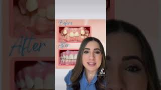 Braces can Change Your Life!