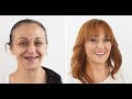 Dentalni makeover 2018 ŠTIMAC CENTRA DENTALNE MEDICINE - Mirela