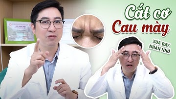 CẮT CƠ CAU MÀY - XÓA BAY NHĂN NHÓ