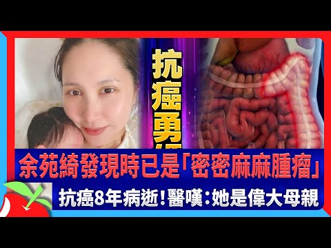 余苑綺發現時已是「密密麻麻腫瘤」　抗癌8年病逝！醫嘆：她是偉大母親 | 台灣新聞 Taiwan 蘋果新聞網