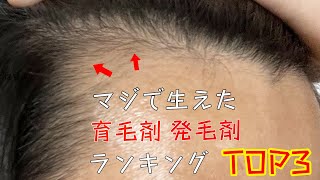 【2022年】一番髪の毛が生えたオススメの育毛剤ランキングTOP3