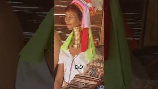 This Isnt Edited  You Wont Believe Why Her Neck Looks Like This