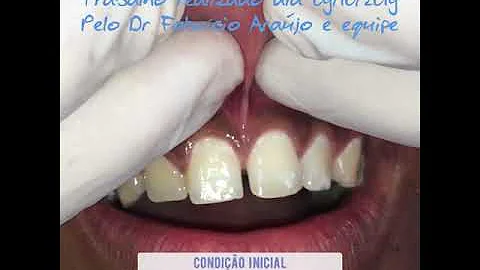 O que acontece se o freio da língua rasgar?