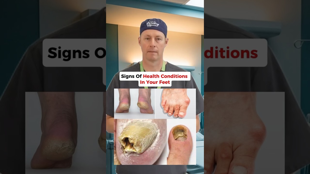 Signs Of Health Conditions In Your Feet 