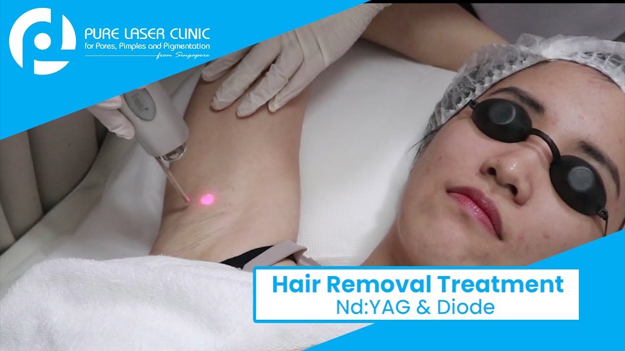 Hair Removal Treatment YouTube
