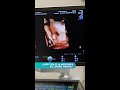Importancia Del Control Prenatal - Panamá Fertility