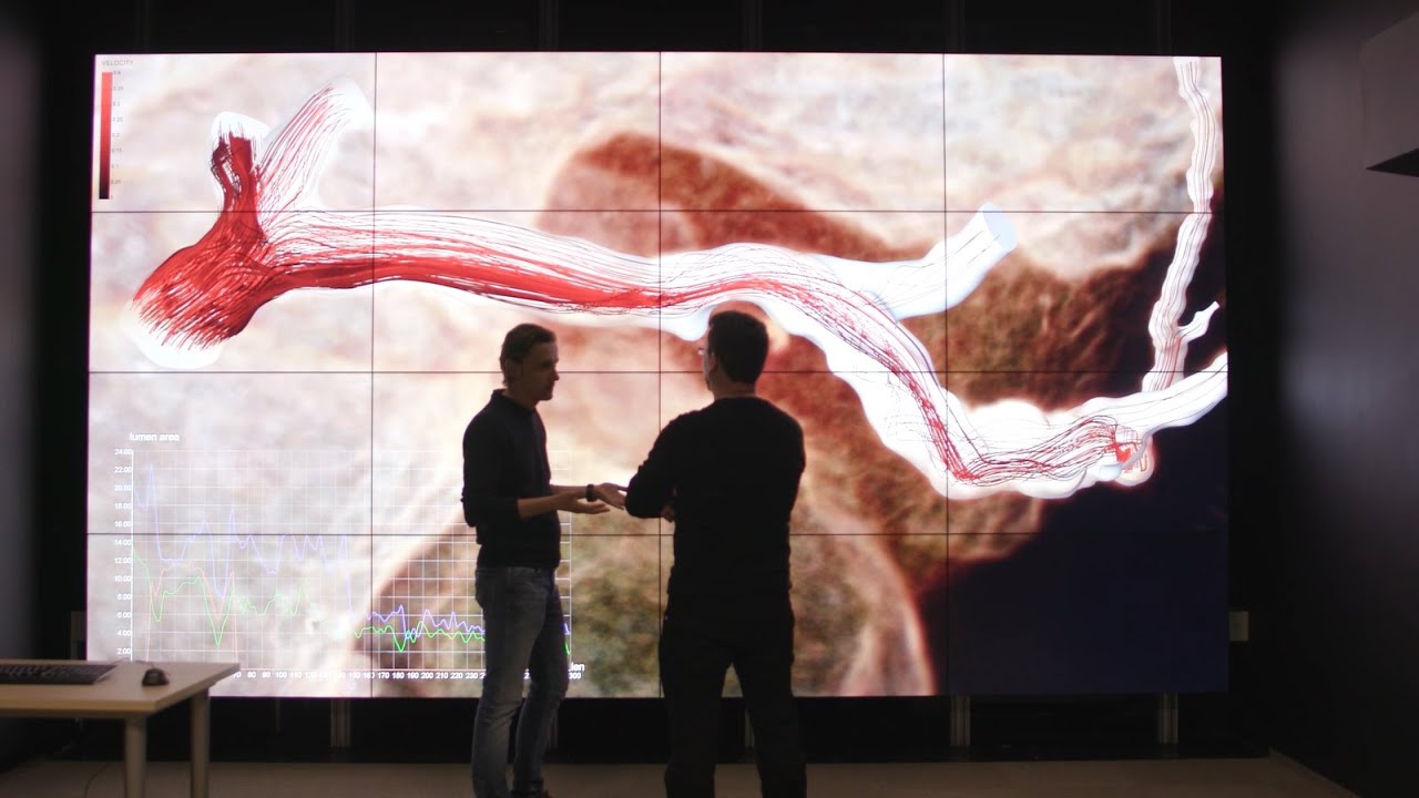 ActiveScale & advancing research at ICM