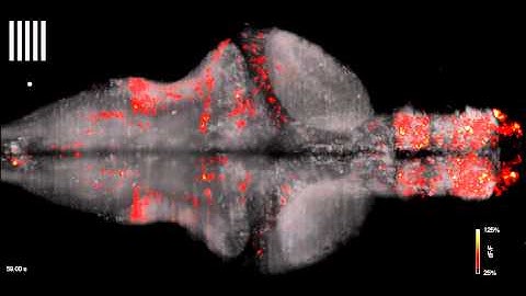 Zebrafish Brain