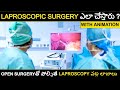 What Is Laproscopy and advantages of laproscopy over Open Surgery Explained in Telugu 2022